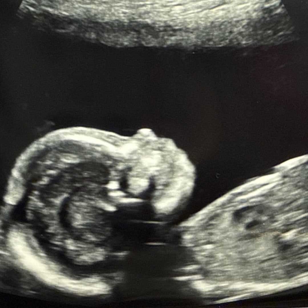 Photo shared by Hannah for their Babylist baby registry.