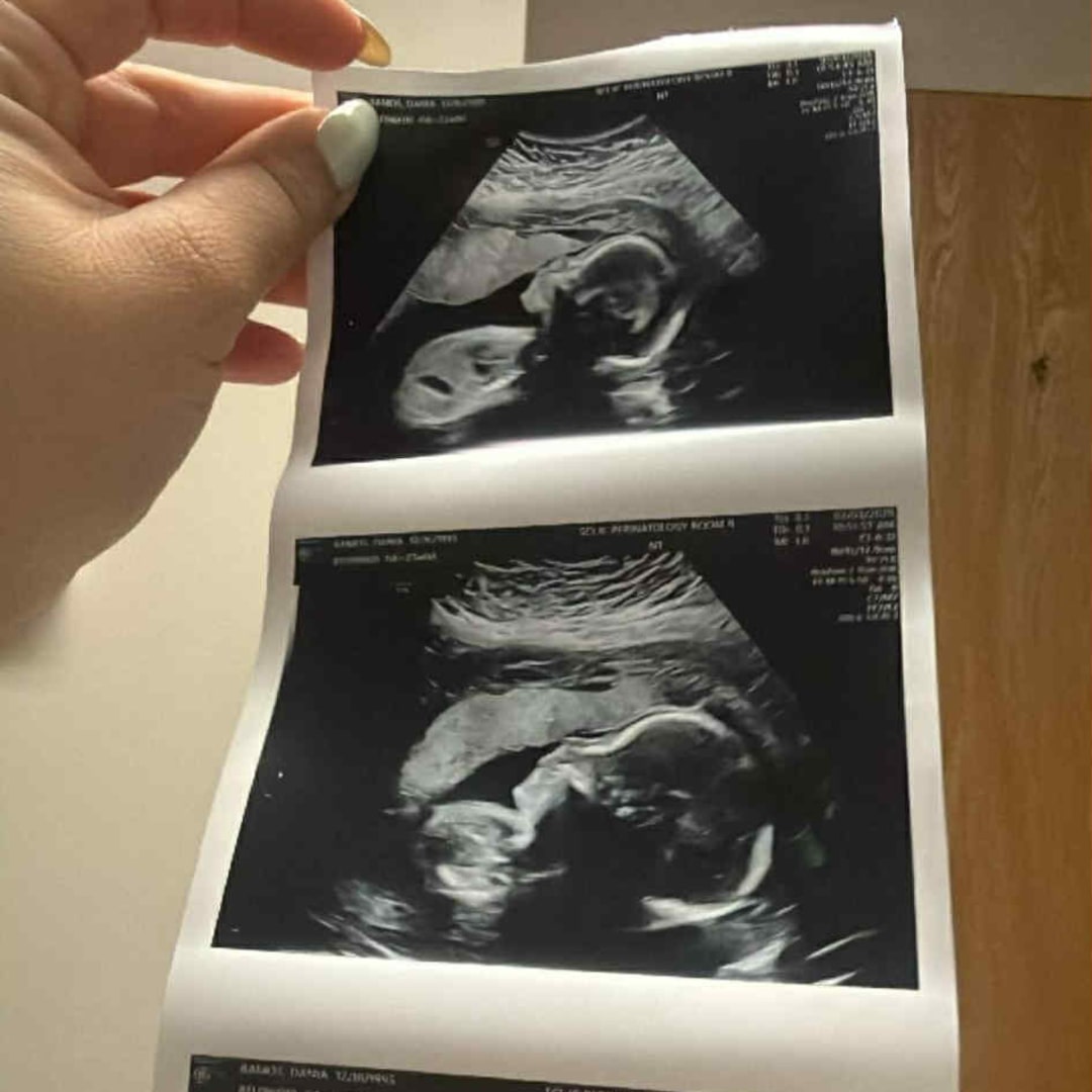 Photo shared by Dania for their Babylist baby registry.