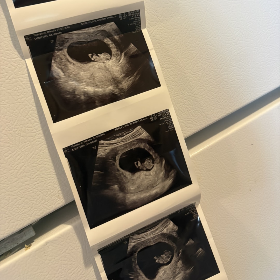 Photo shared by Mikaela for their Babylist baby registry.