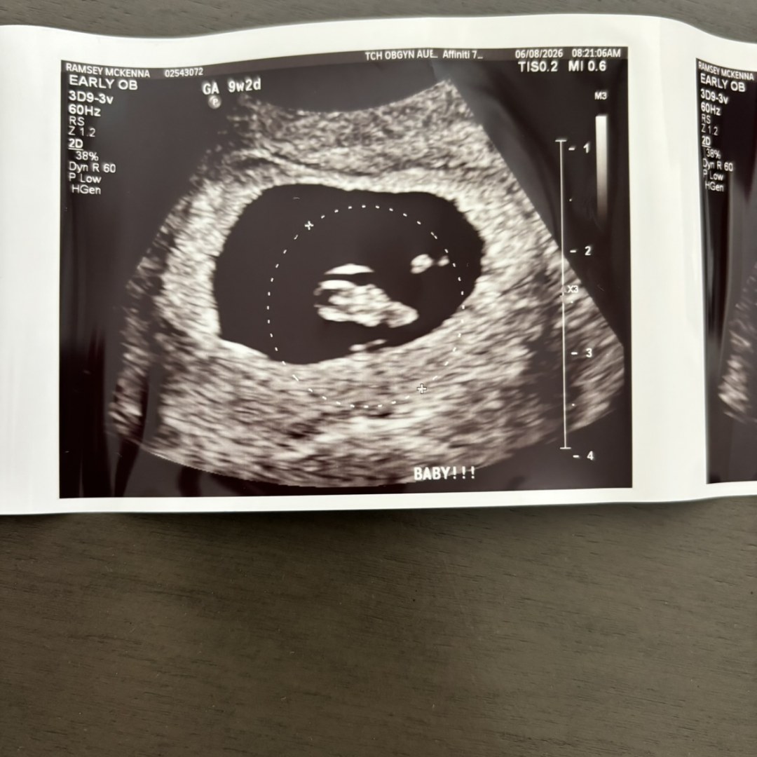 Photo shared by McKenna for their Babylist baby registry.
