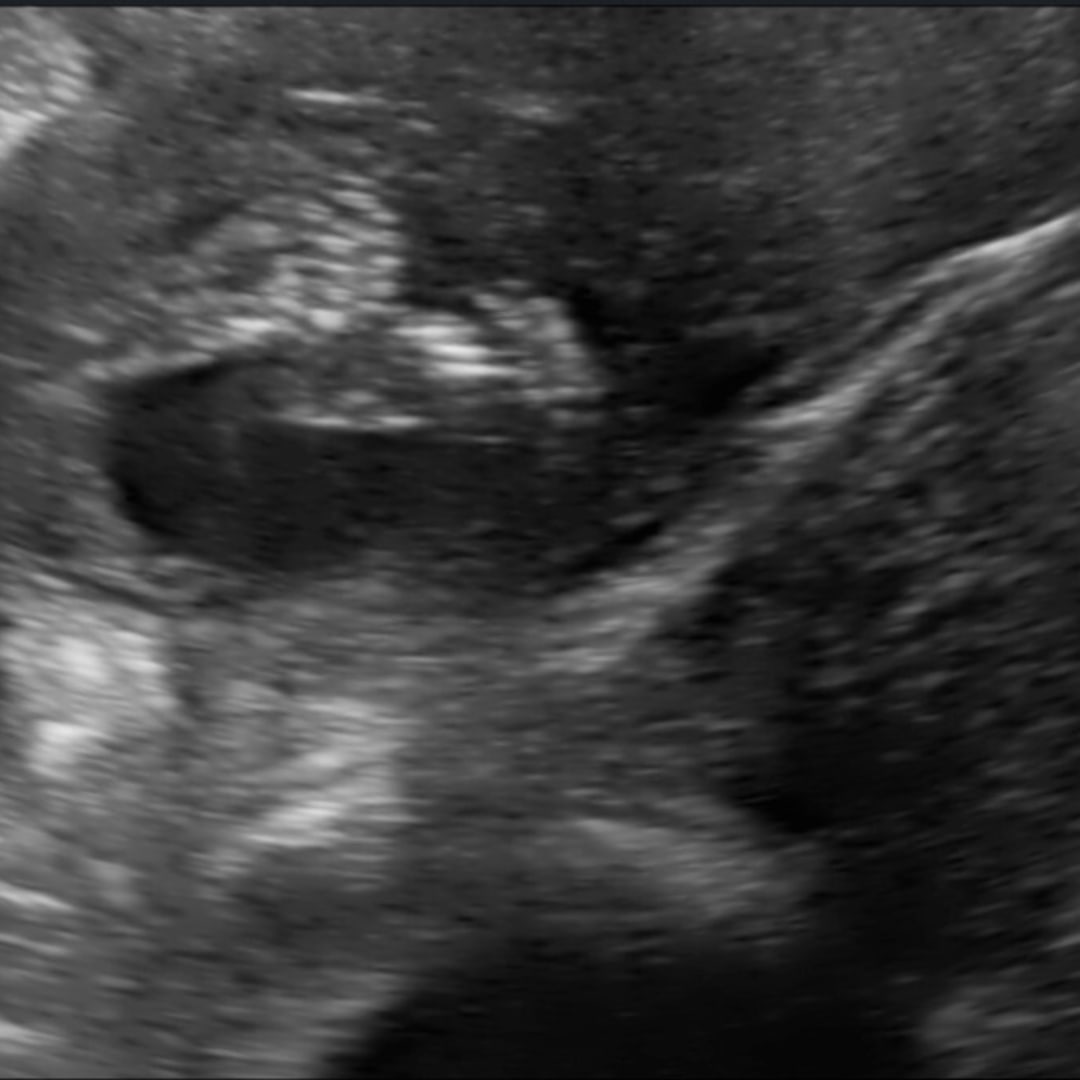 Photo shared by Amy for their Babylist baby registry.