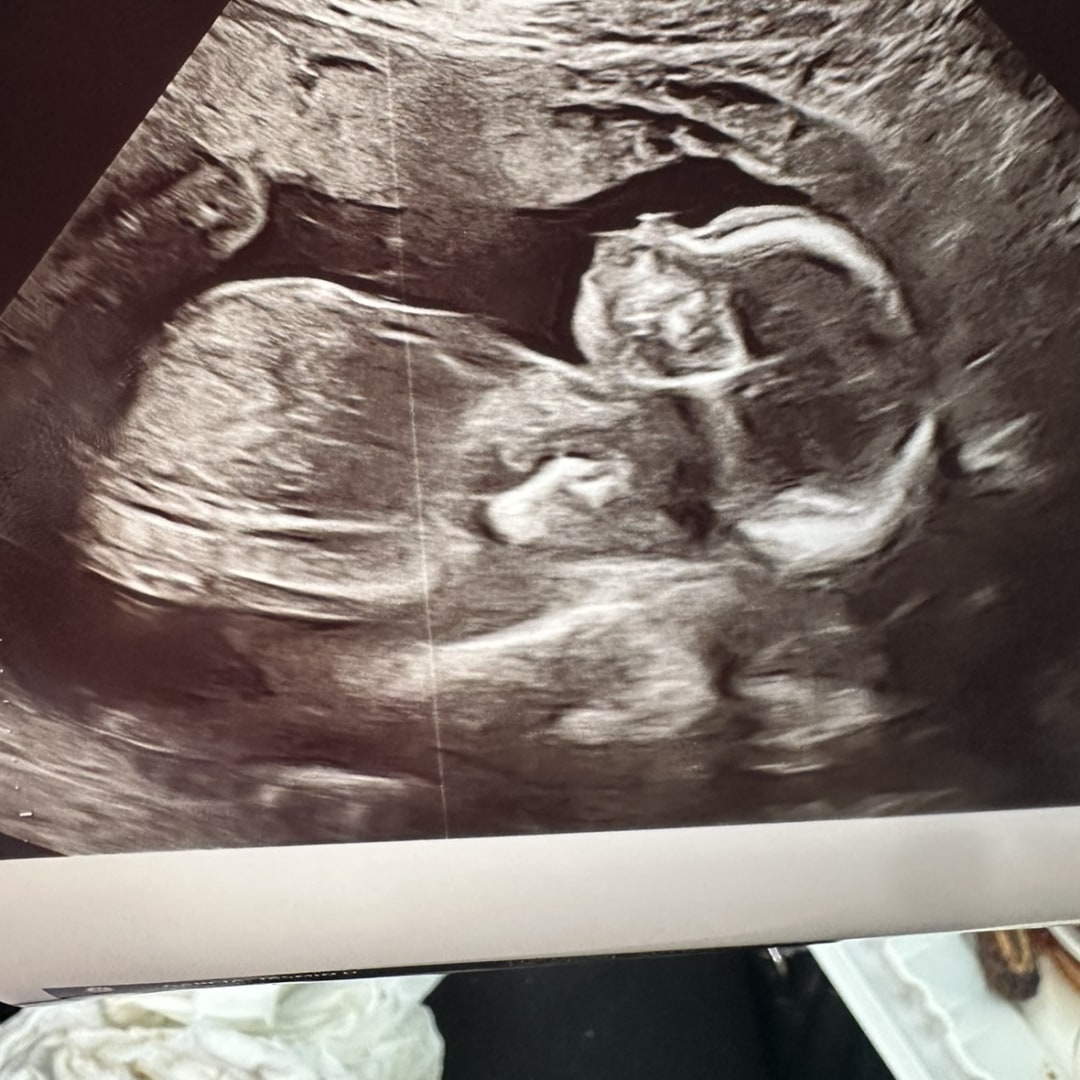 Photo shared by Jasmin for their Babylist baby registry.