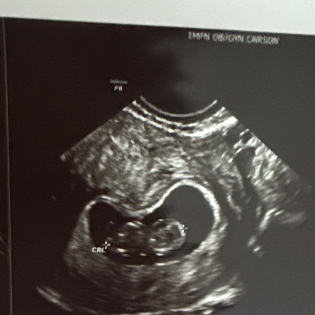 Photo shared by Carina for their Babylist baby registry.