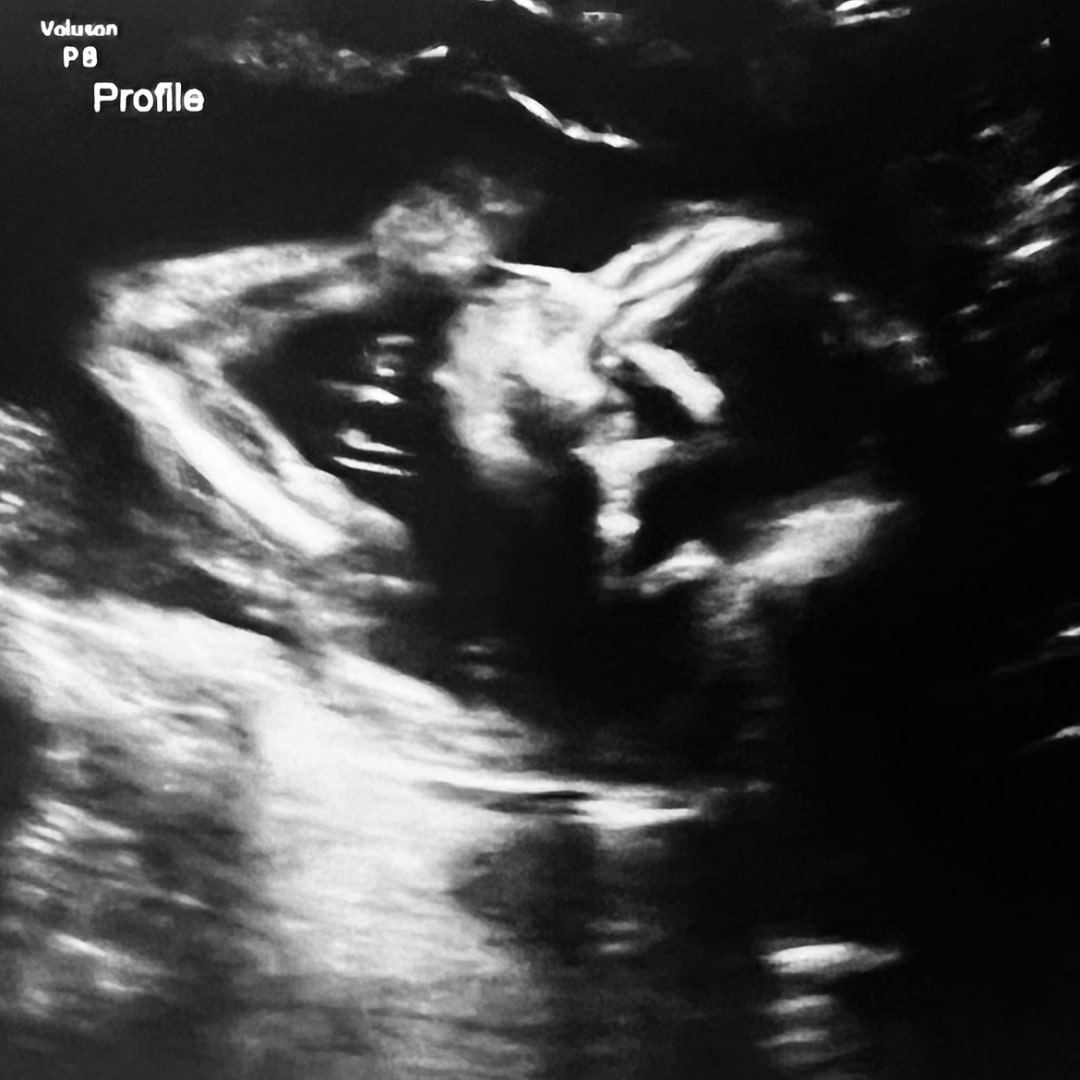 Photo shared by Valorie for their Babylist baby registry.