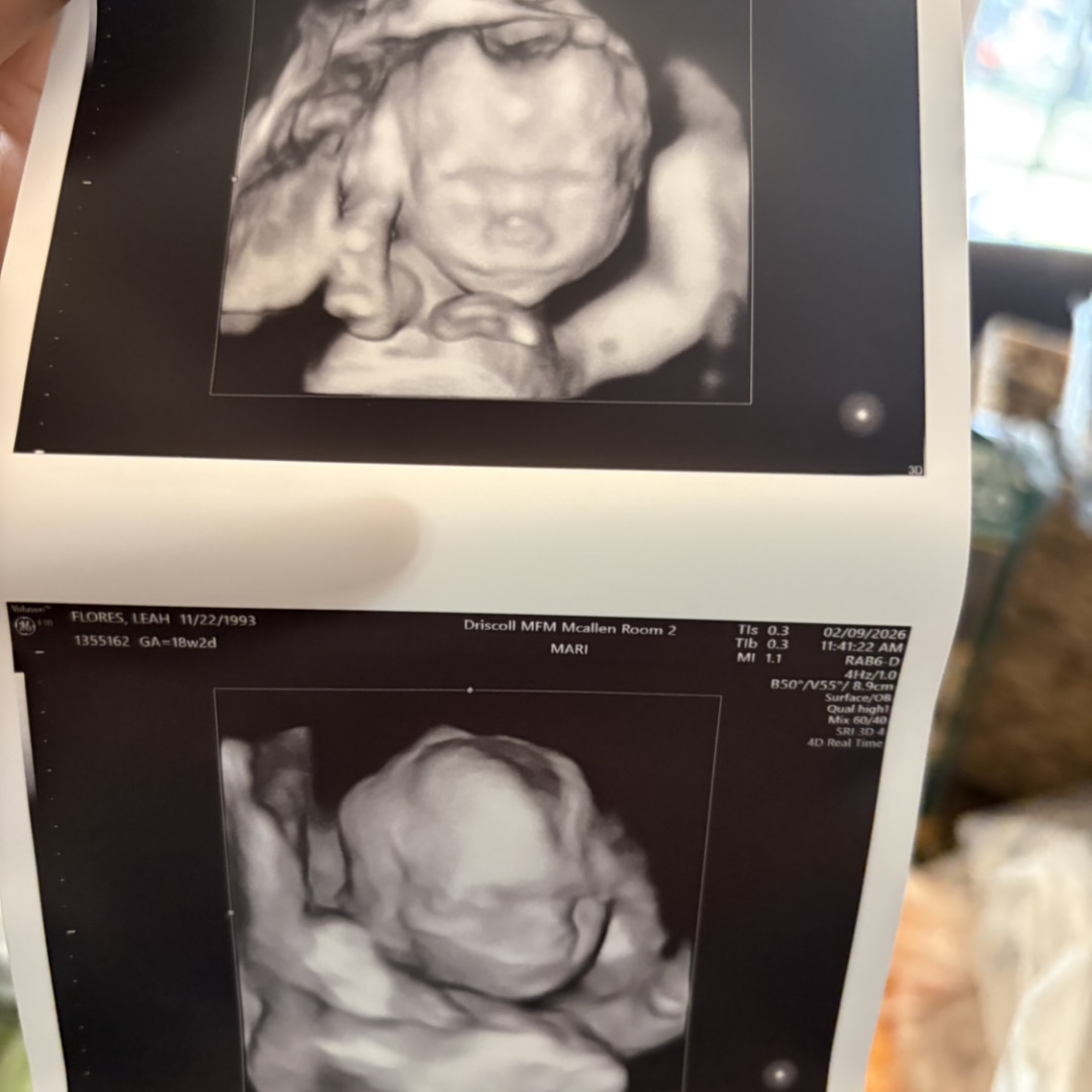 Photo shared by Leah for their Babylist baby registry.