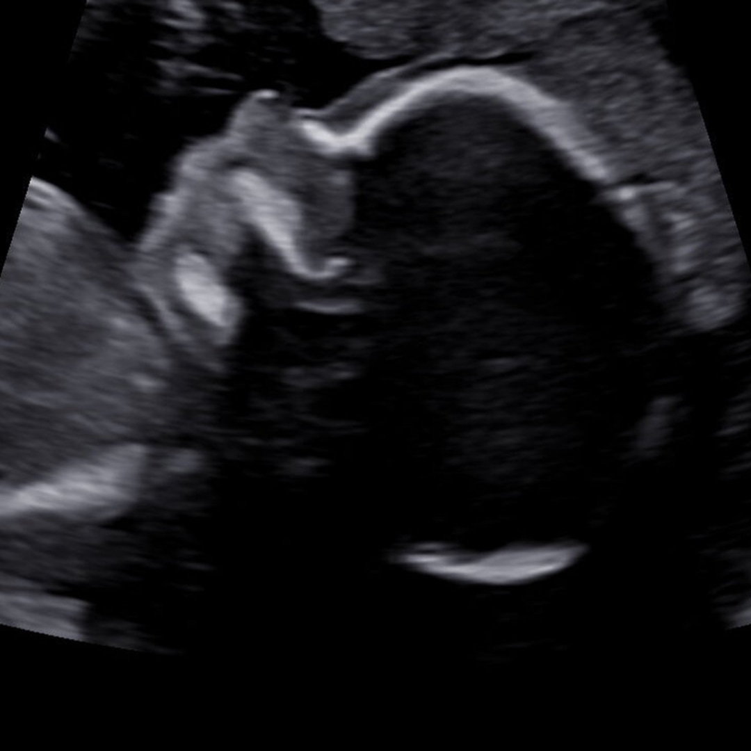 Photo shared by Grace for their Babylist baby registry.