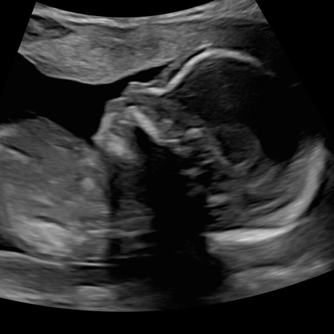 Photo shared by Diego for their Babylist baby registry.