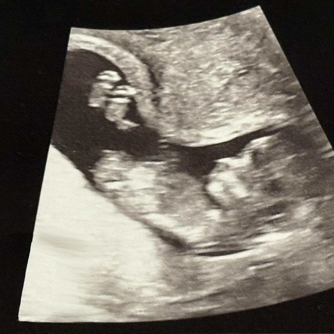 Photo shared by Brittney for their Babylist baby registry.
