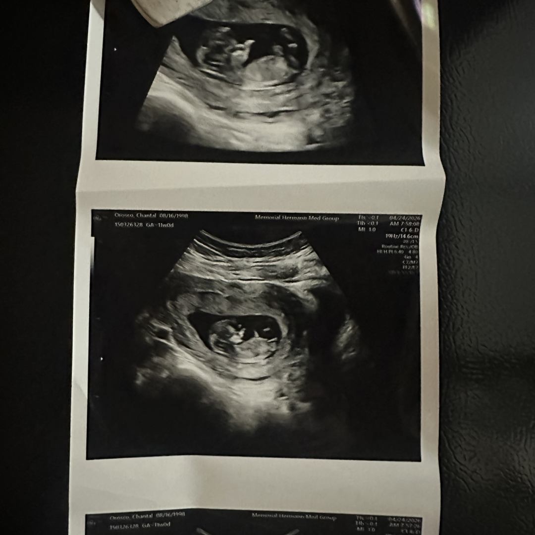 Photo shared by Chantal for their Babylist baby registry.