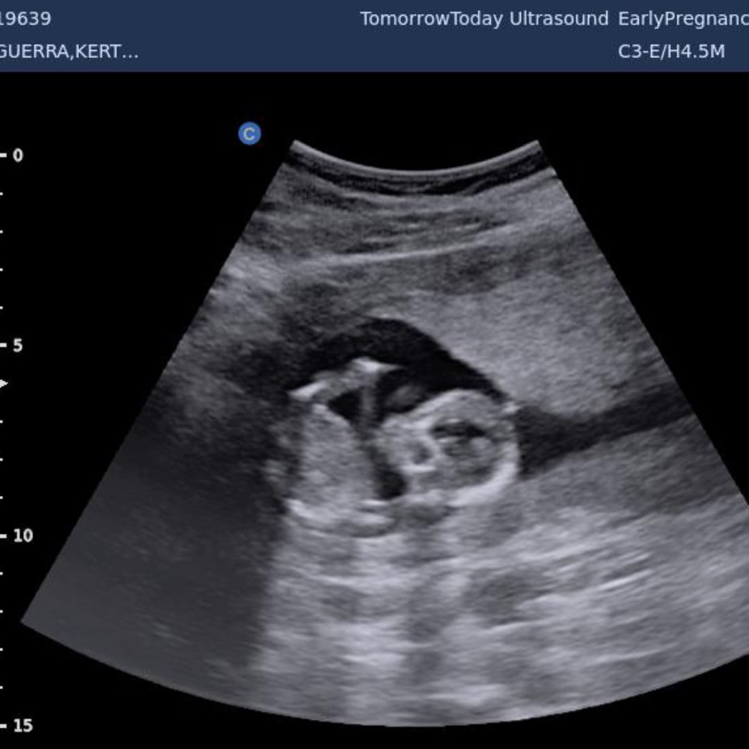 Photo shared by Kerterial for their Babylist baby registry.