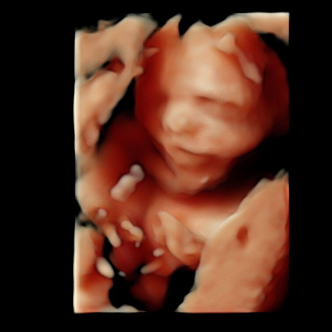 Photo shared by Amanda for their Babylist baby registry.