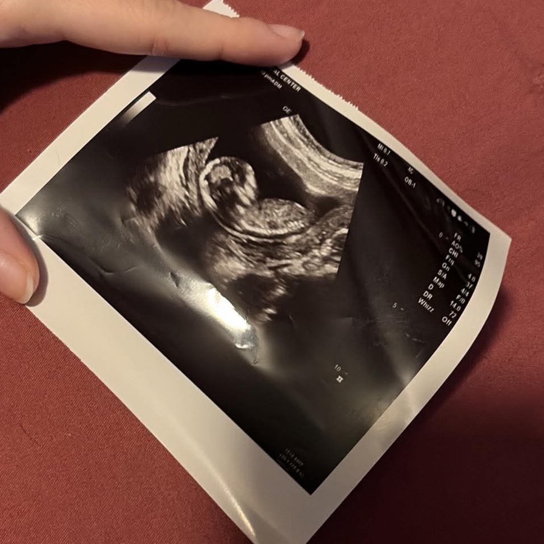 Photo shared by Skylenn for their Babylist baby registry.