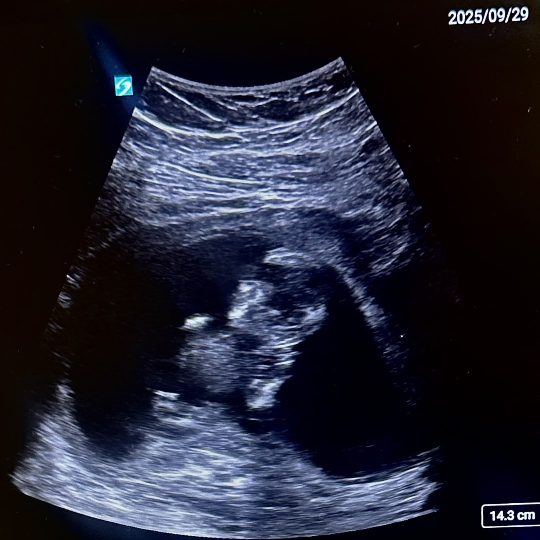 Photo shared by Emily for their Babylist baby registry.