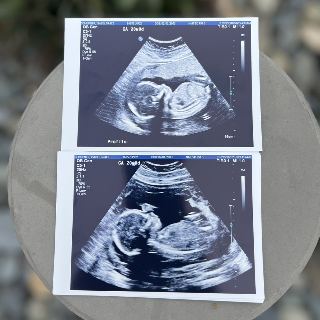 Photo shared by Isabel for their Babylist baby registry.
