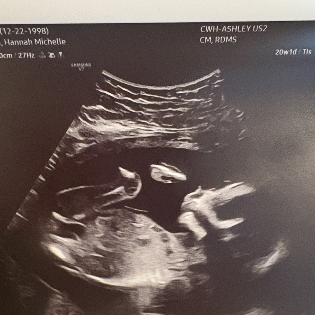 Photo shared by Hannah for their Babylist baby registry.