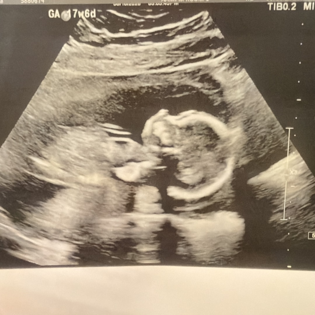 Photo shared by Karina for their Babylist baby registry.