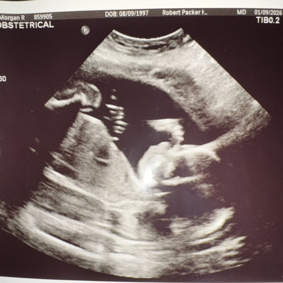 Photo shared by Morgan for their Babylist baby registry.