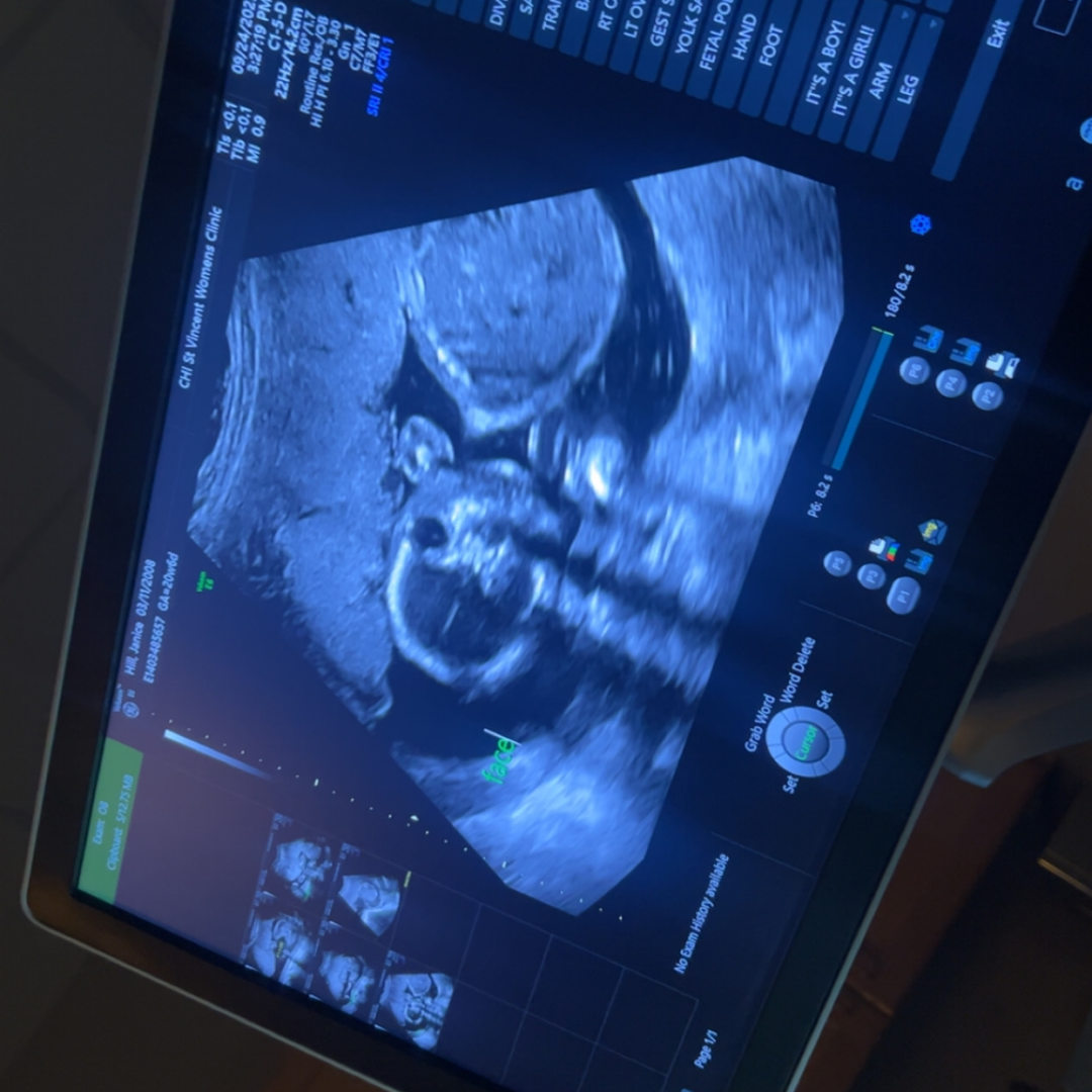 Photo shared by Shyanna for their Babylist baby registry.