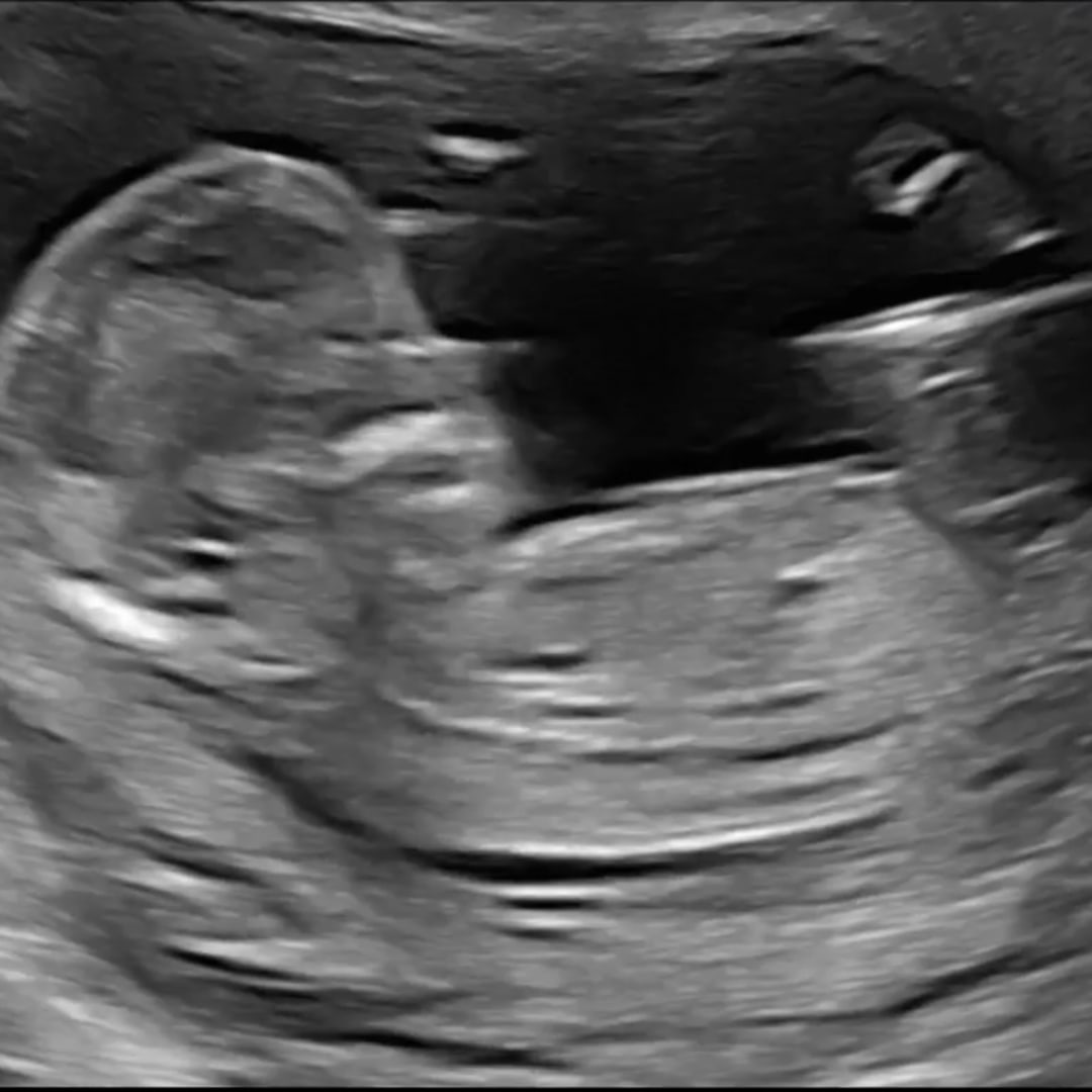 Photo shared by Lena for their Babylist baby registry.