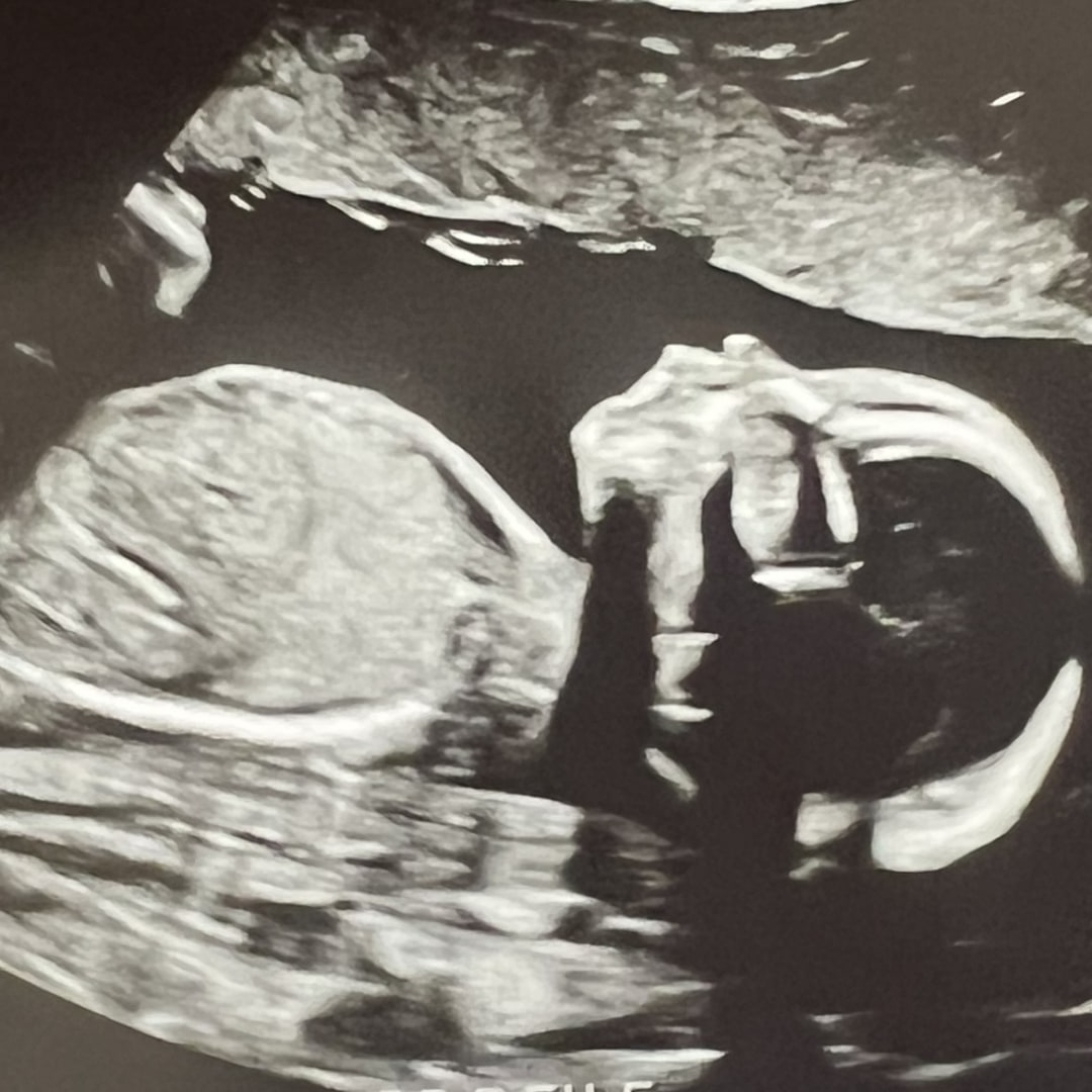 Photo shared by Katie for their Babylist baby registry.