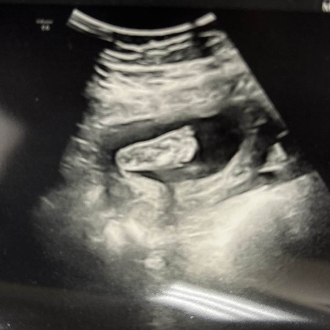 Photo shared by Kandis for their Babylist baby registry.