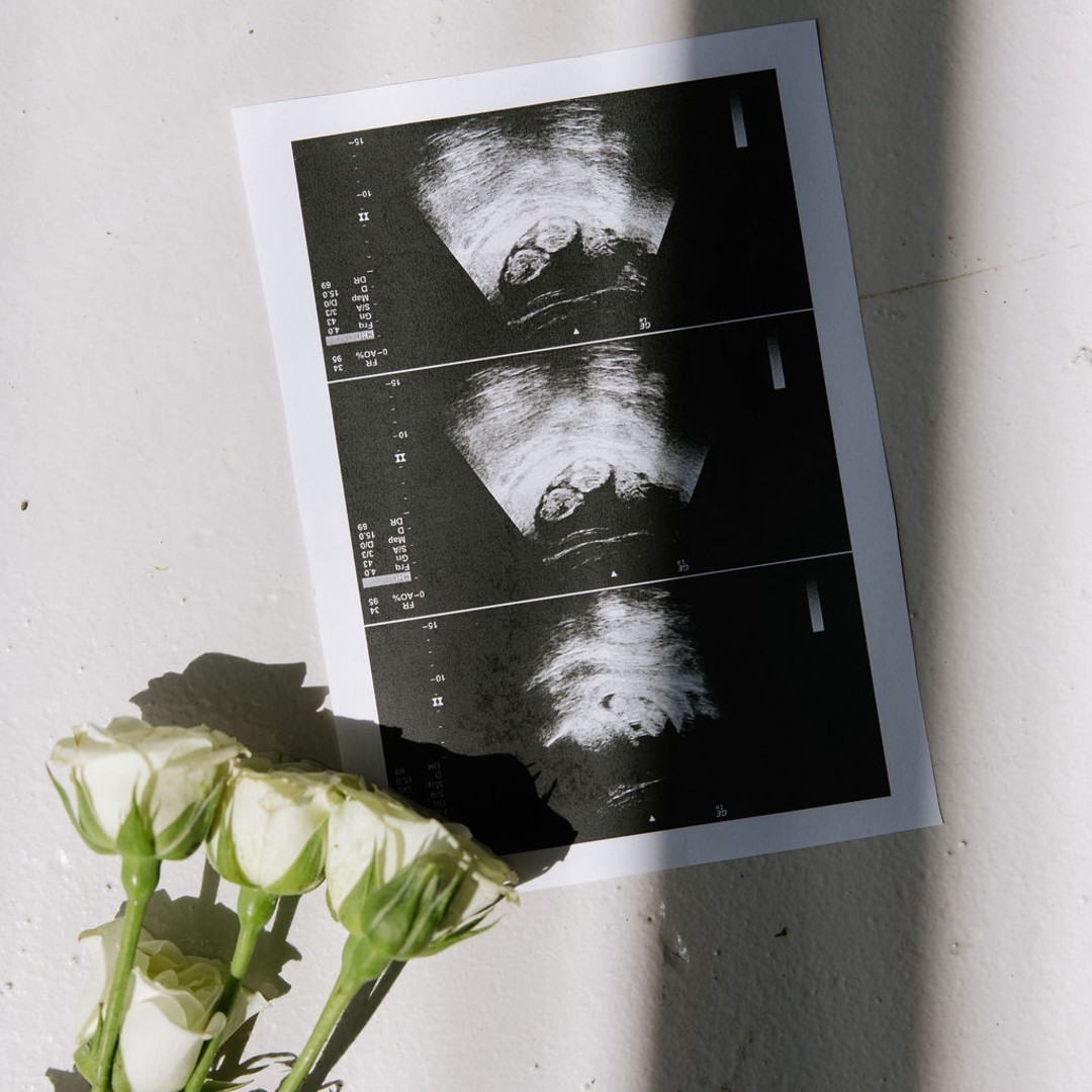 Photo shared by Emma for their Babylist baby registry.