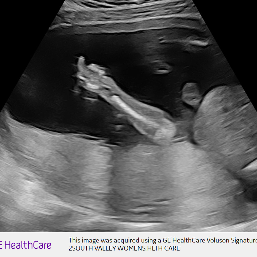 Photo shared by Sammi for their Babylist baby registry.