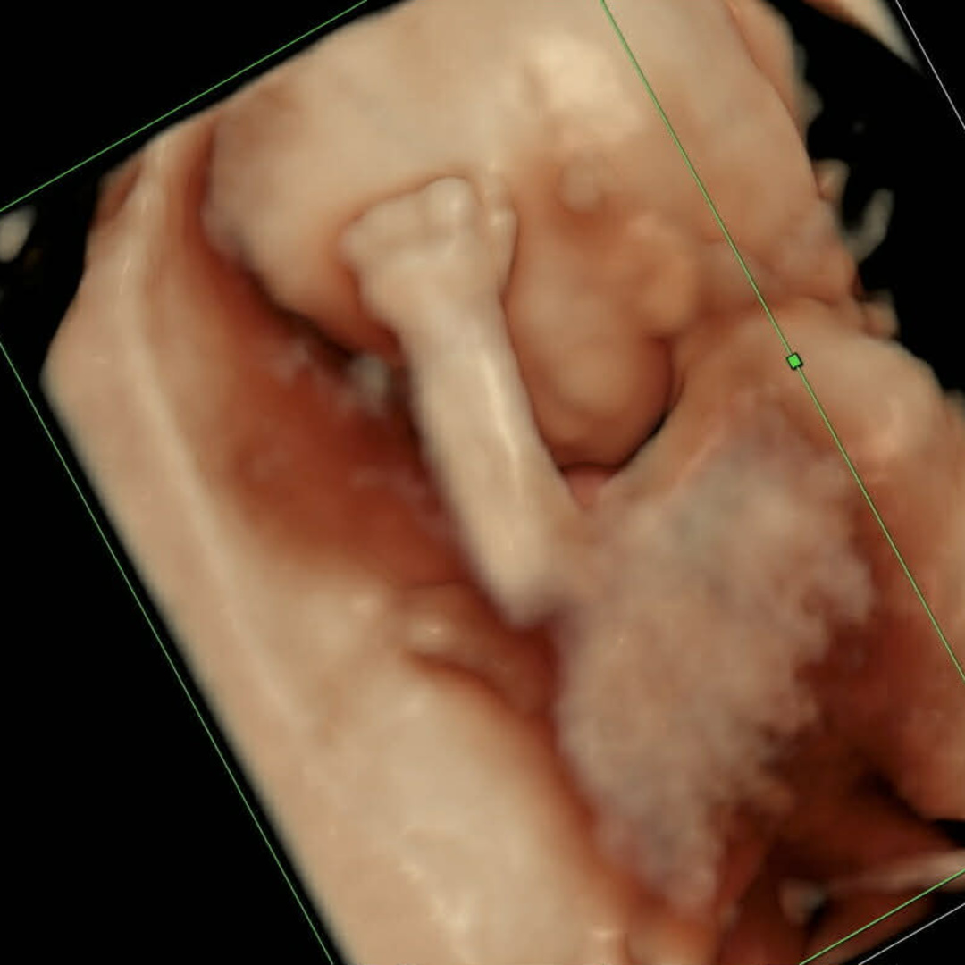 Photo shared by Nicole for their Babylist baby registry.