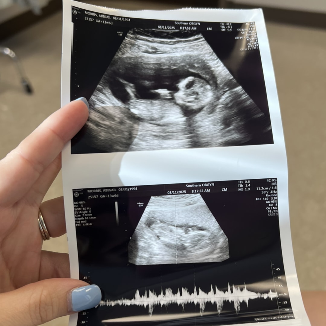 Photo shared by Abigail for their Babylist baby registry.