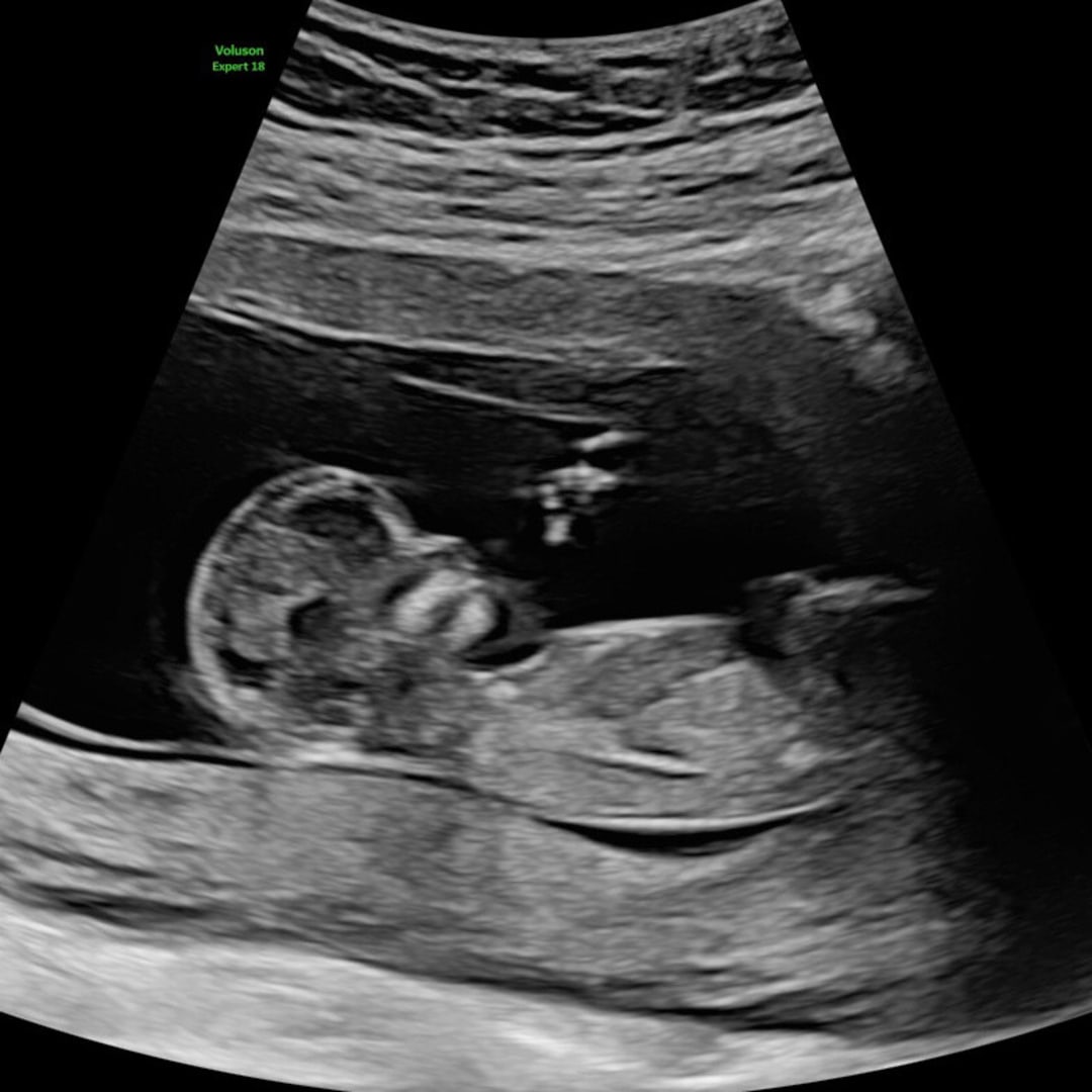 Photo shared by Rachel for their Babylist baby registry.