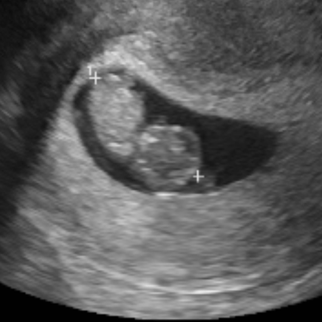 Photo shared by Mercedes for their Babylist baby registry.