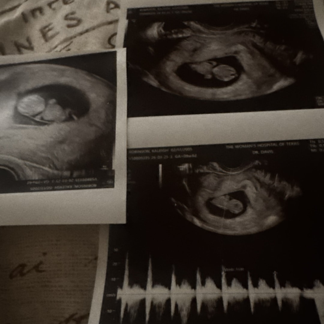 Photo shared by Kaleigh for their Babylist baby registry.