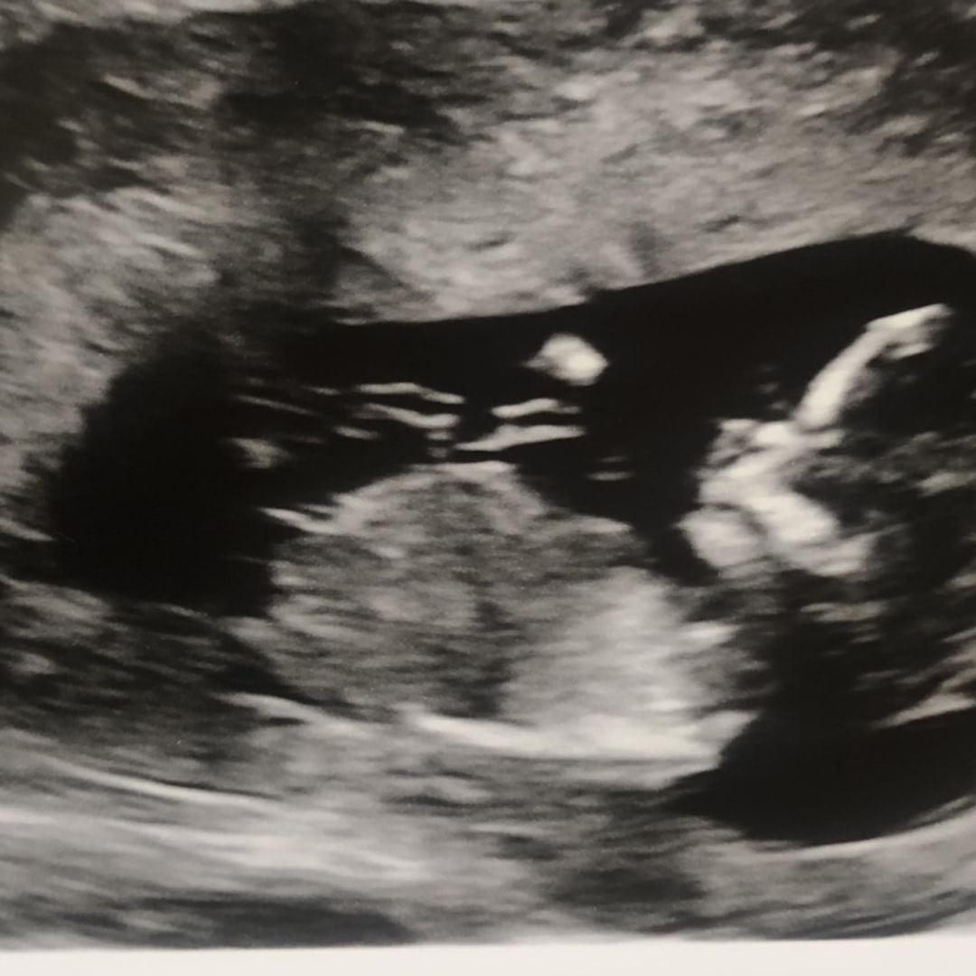 Photo shared by Alicia for their Babylist baby registry.