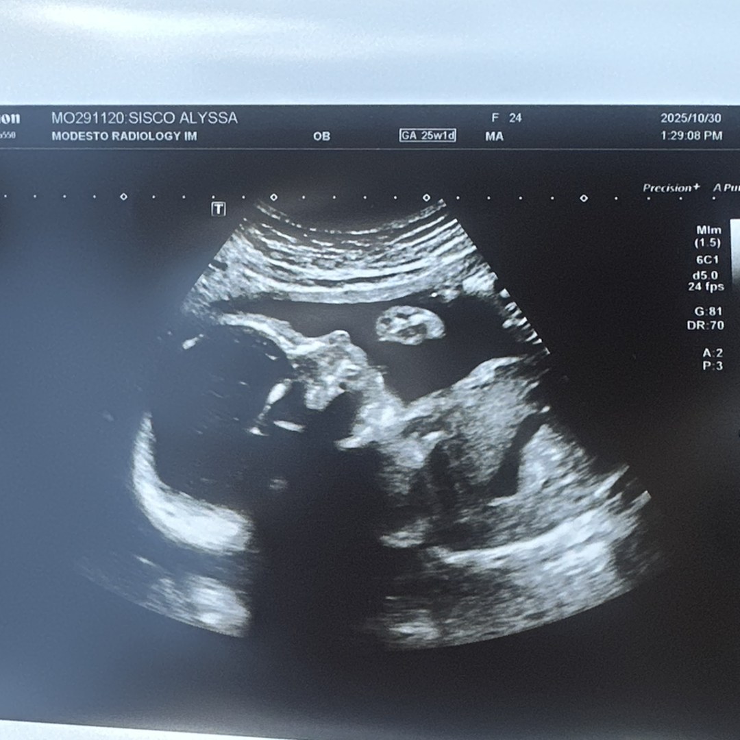 Photo shared by Alyssa for their Babylist baby registry.