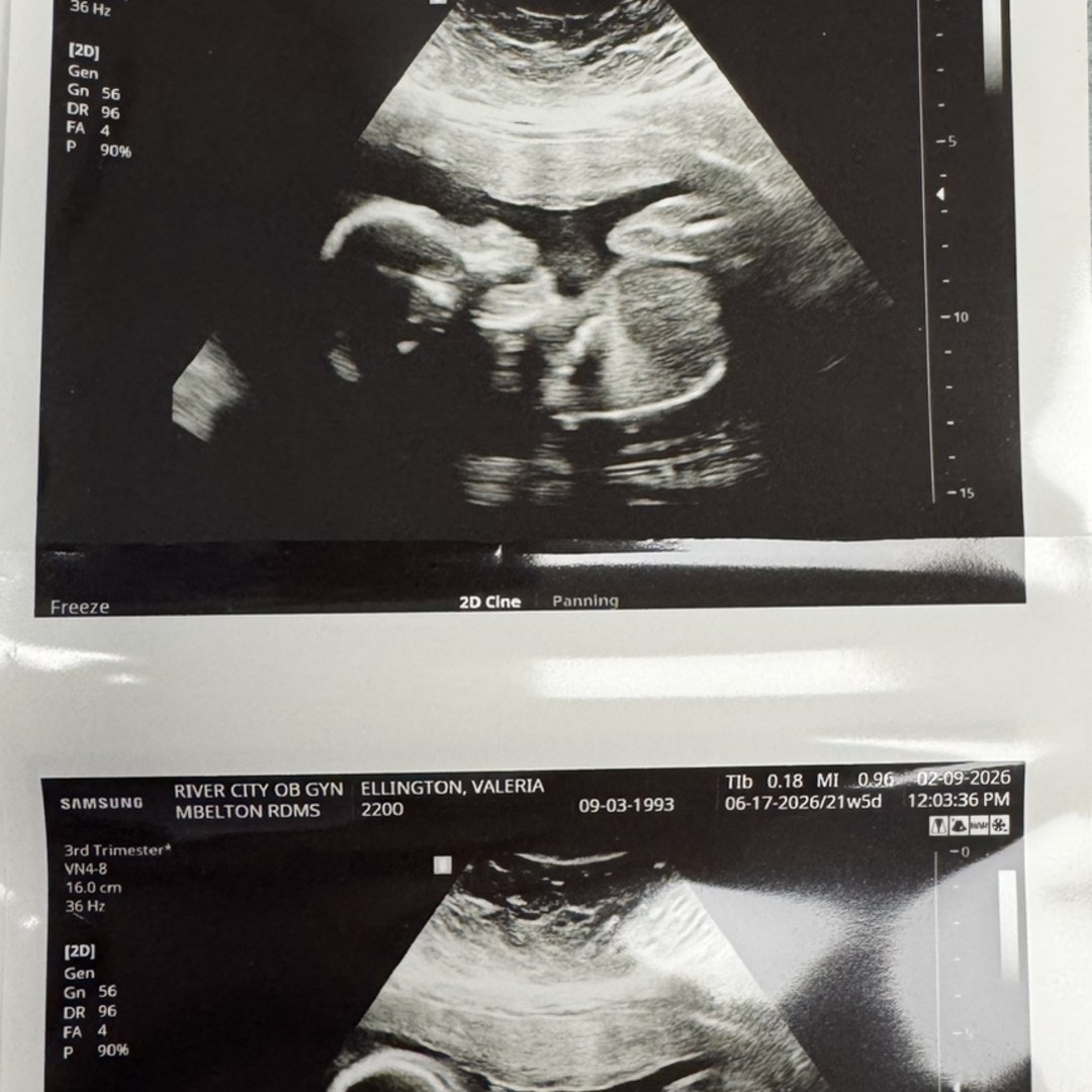 Photo shared by Valeria for their Babylist baby registry.