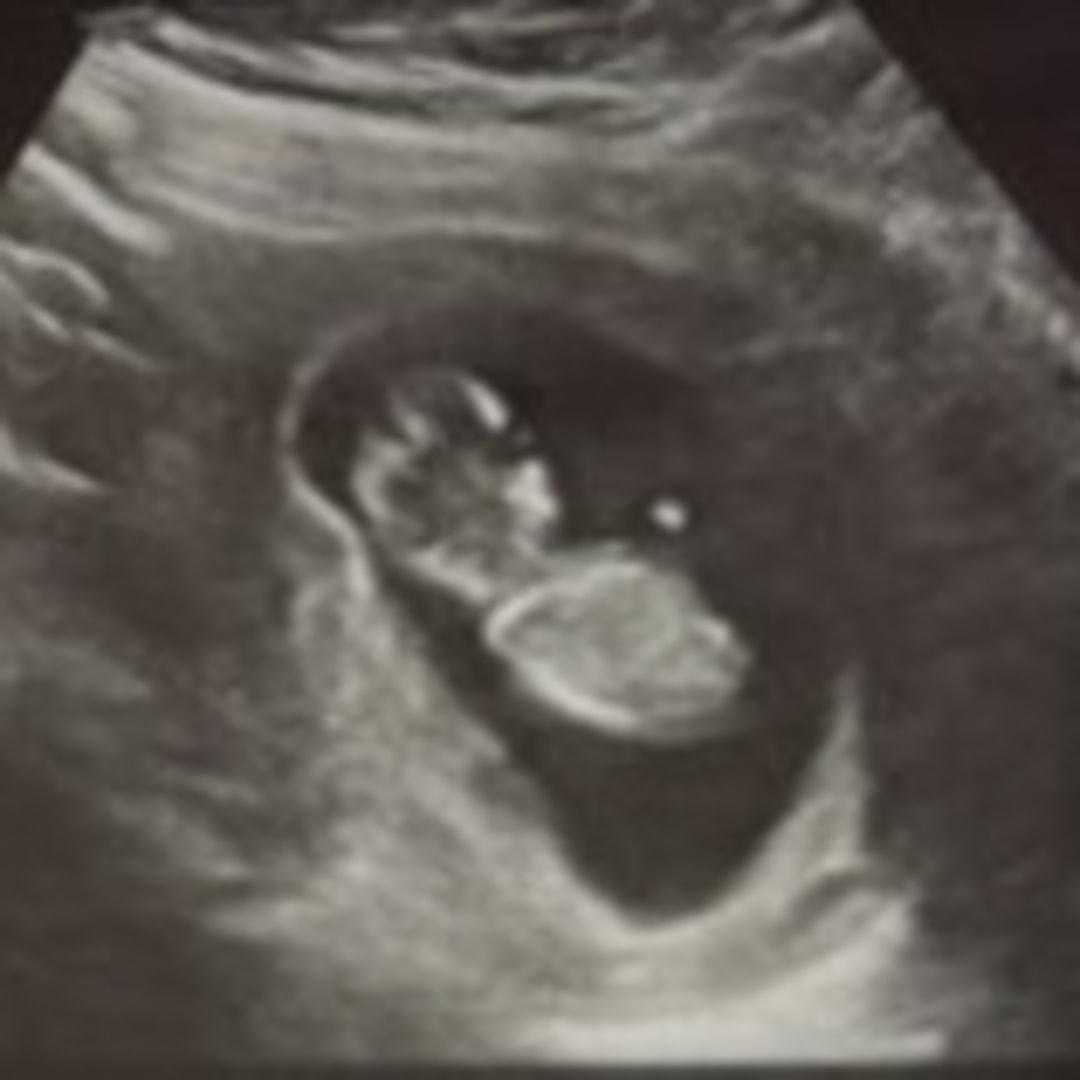 Photo shared by Siera for their Babylist baby registry.