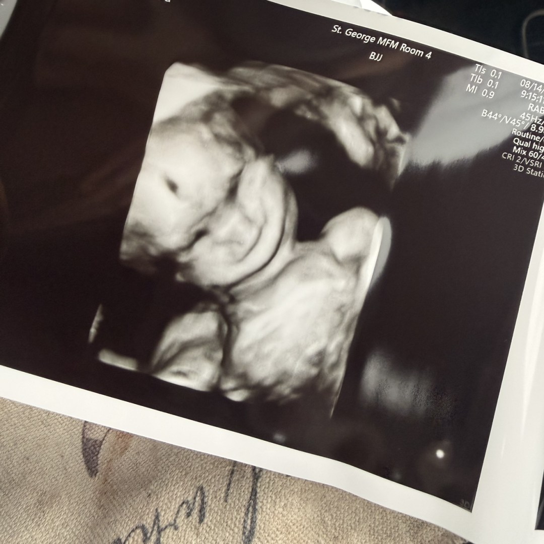 Photo shared by Amanda for their Babylist baby registry.