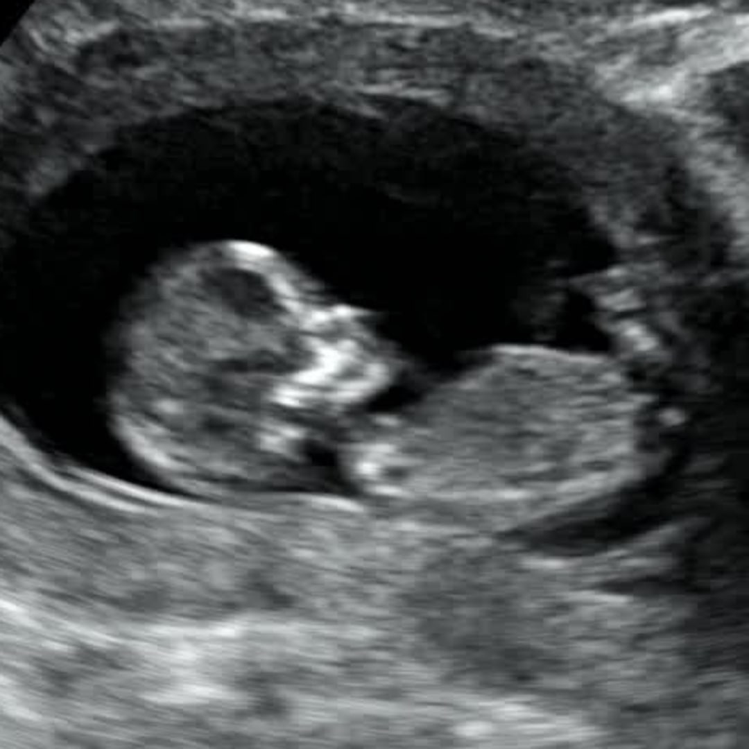 Photo shared by Emily for their Babylist baby registry.