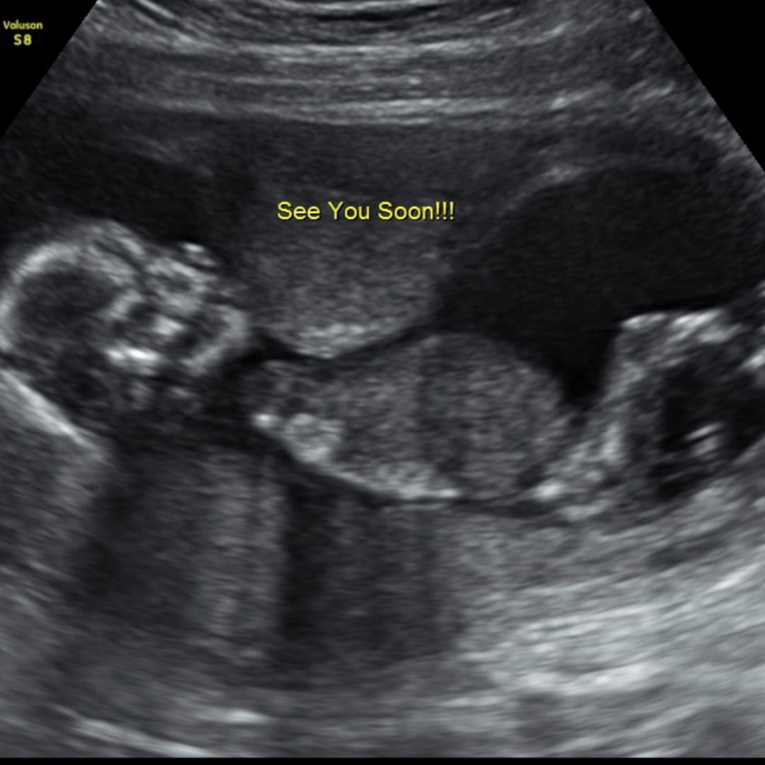 Photo shared by Analiza for their Babylist baby registry.