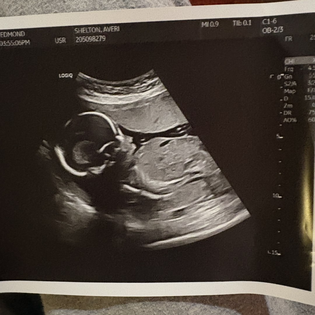 Photo shared by Averi for their Babylist baby registry.