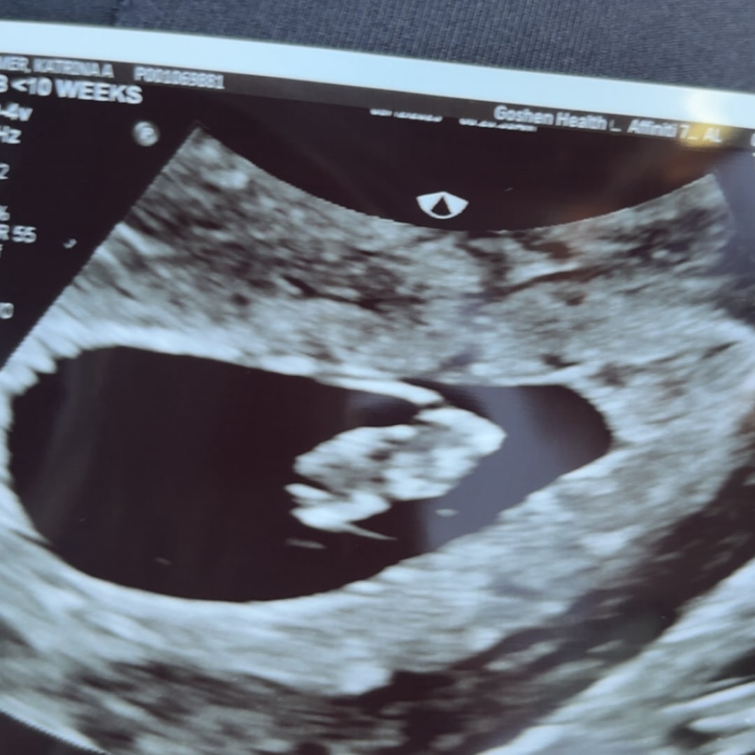 Photo shared by Katrina for their Babylist baby registry.