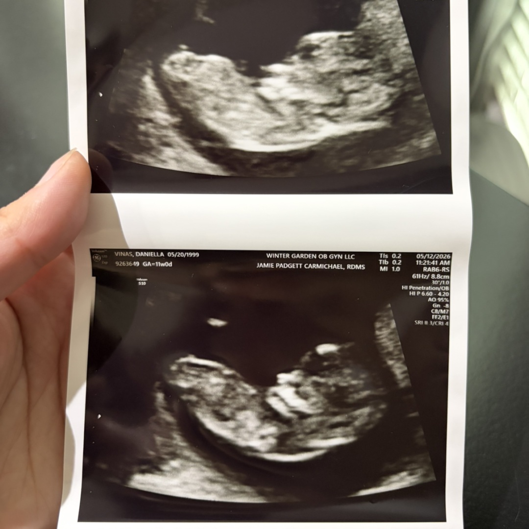 Photo shared by Daniella for their Babylist baby registry.