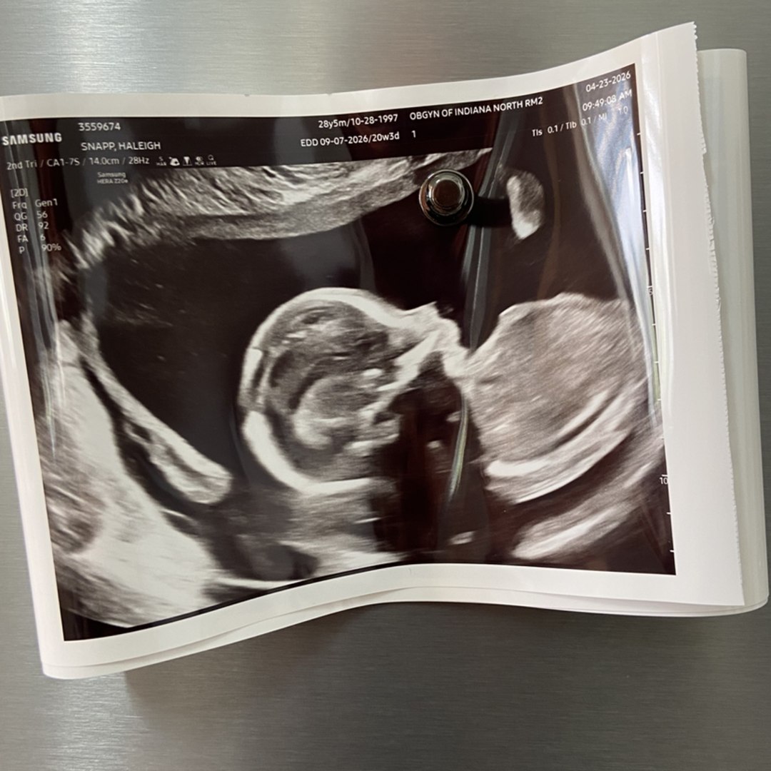 Photo shared by Haleigh for their Babylist baby registry.