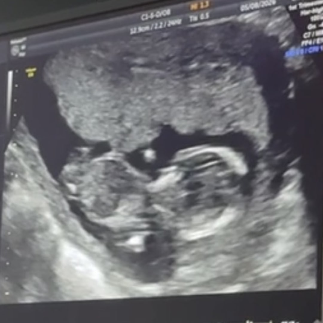 Photo shared by Hannah for their Babylist baby registry.