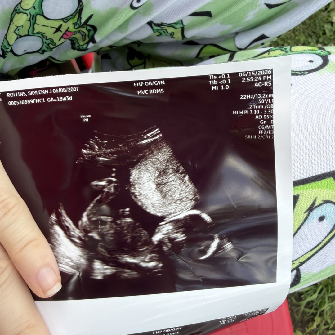 Photo shared by Skylenn for their Babylist baby registry.