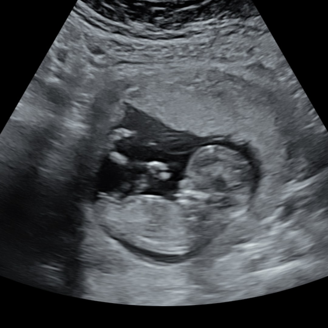 Photo shared by Trinh for their Babylist baby registry.