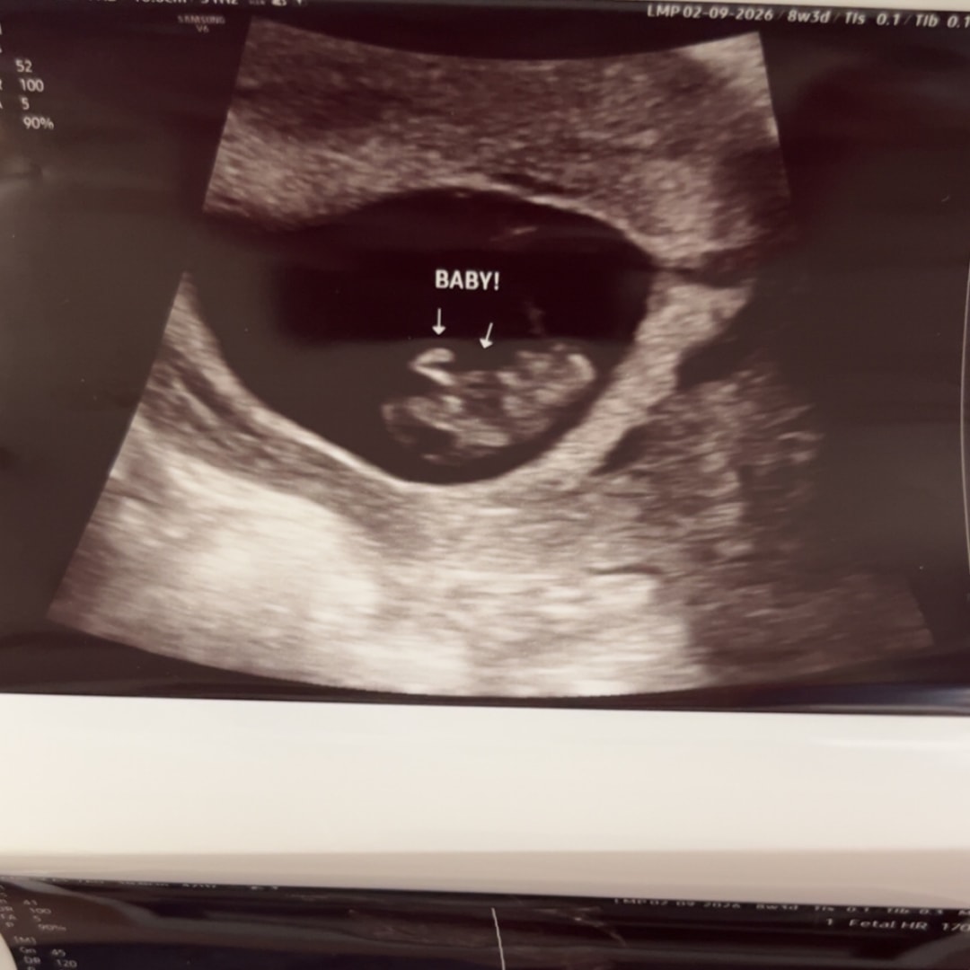 Photo shared by Allie for their Babylist baby registry.