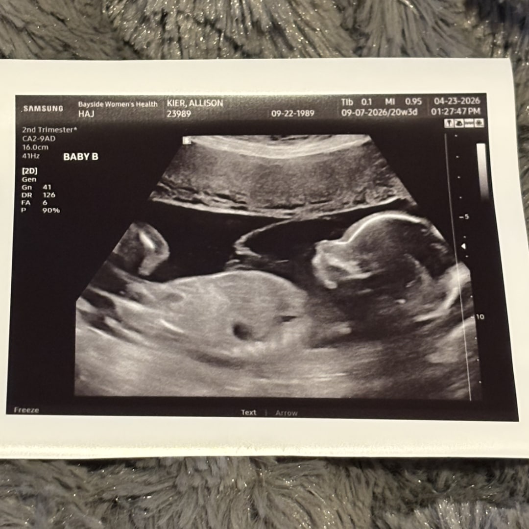 Photo shared by Allison for their Babylist baby registry.