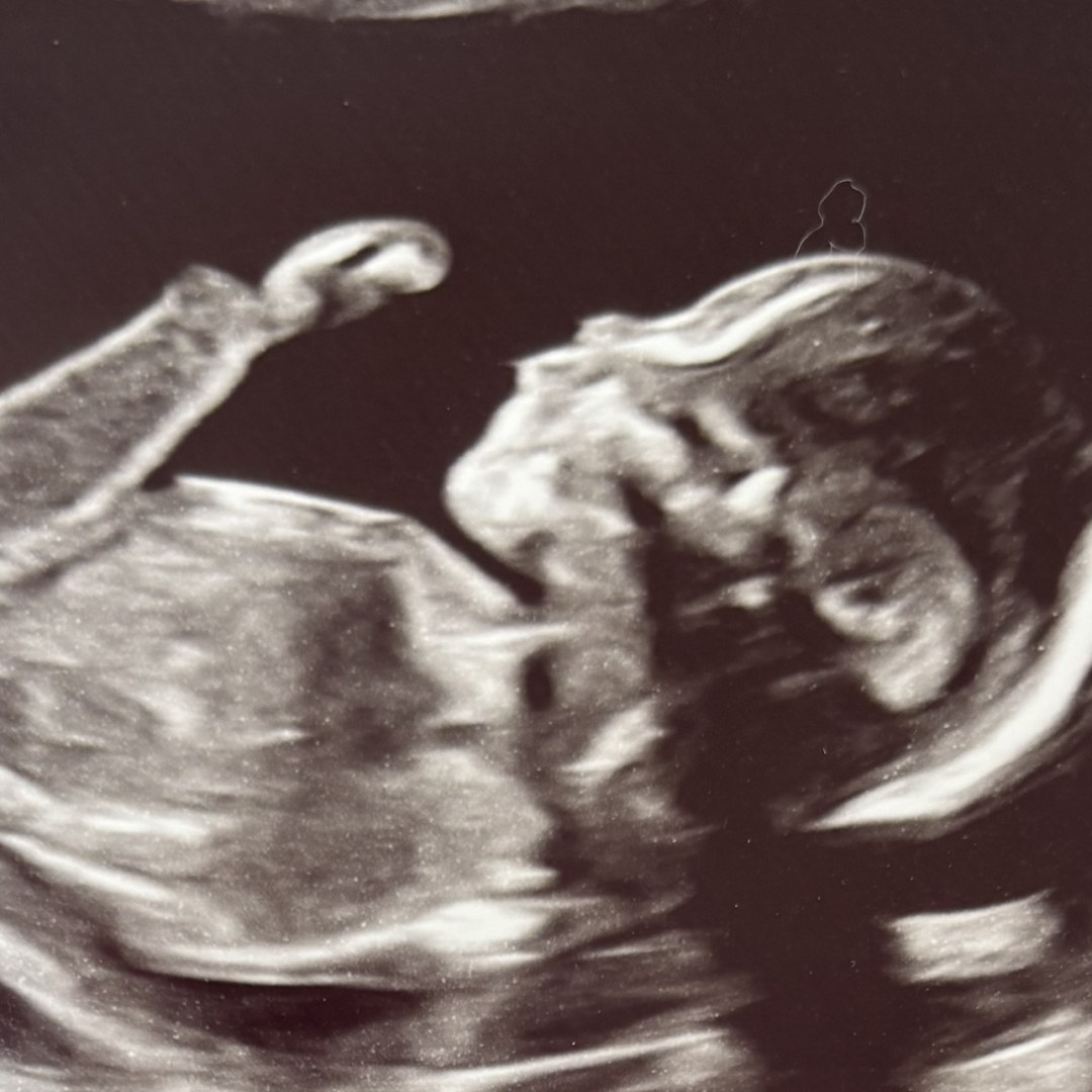 Photo shared by Emily for their Babylist baby registry.