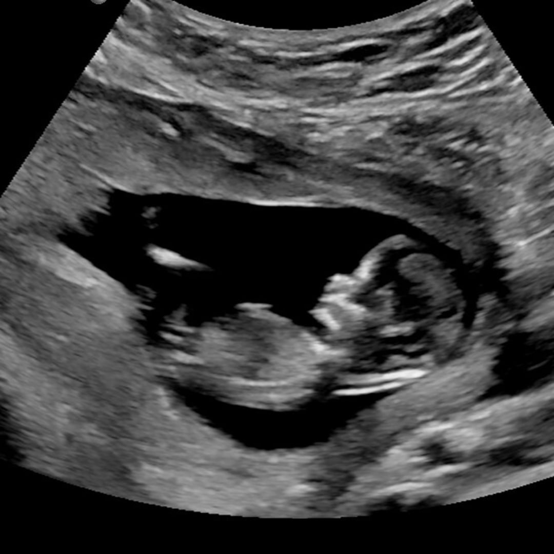 Photo shared by Paulina for their Babylist baby registry.